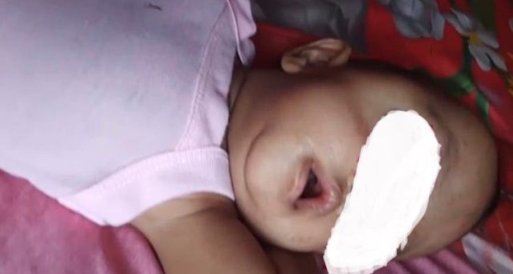 Pemkab beserta DPRD Madina menggalang donasi untuk pengobatan anak mengidap kanker mata yang dirawat di RS M Jamil Padang. 